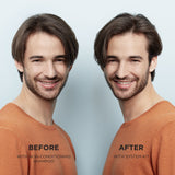 Nioxin System 1 Treatment for Natural Hair with Light Thinning